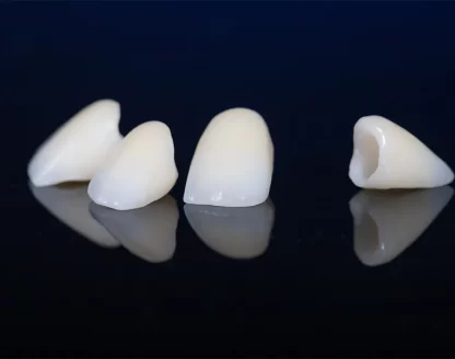 My Dental Crown Broke After 2 Years. Is It Possible to Fix It? 